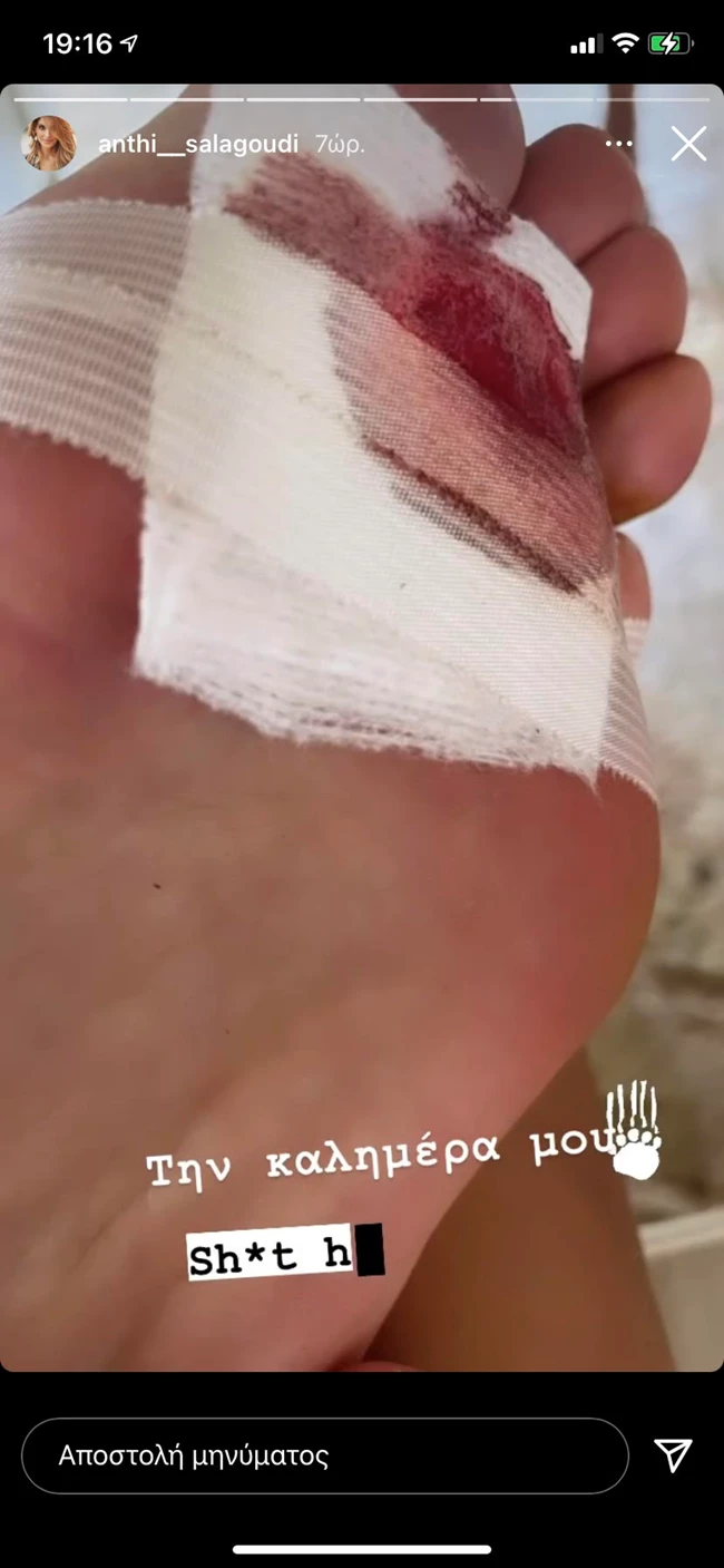 Ατύχημα για την Ανθή Σαλαγκούδη | Τι ακριβώς της συνέβη;