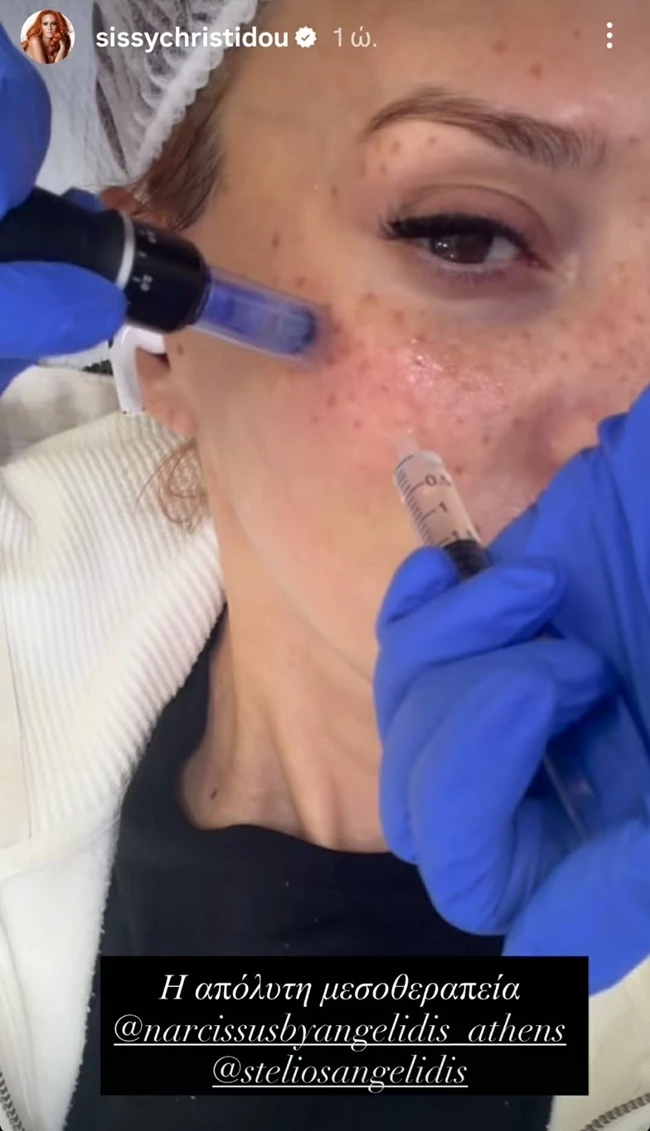 θεραπεία προσώπου Χρηστίδου