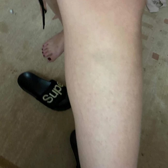 "Υπήρχαν σημάδια στα πόδια μου. Πάρα πολλές μελανιές" | Οι φωτογραφίες της 24χρονης Γεωργίας που σοκάρουν