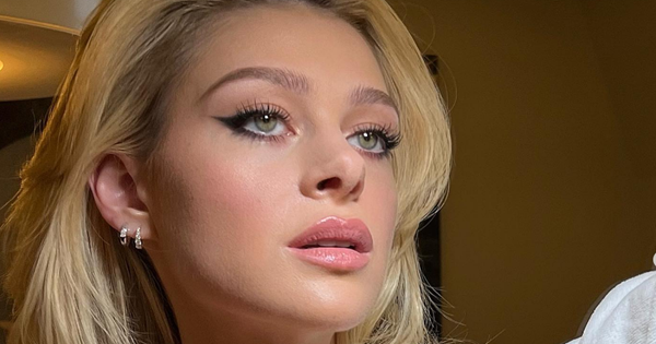 Αγνώριστη η Nicola Peltz 10 χρόνια πριν | Δες την τεράστια αλλαγή στο πρόσωπό της