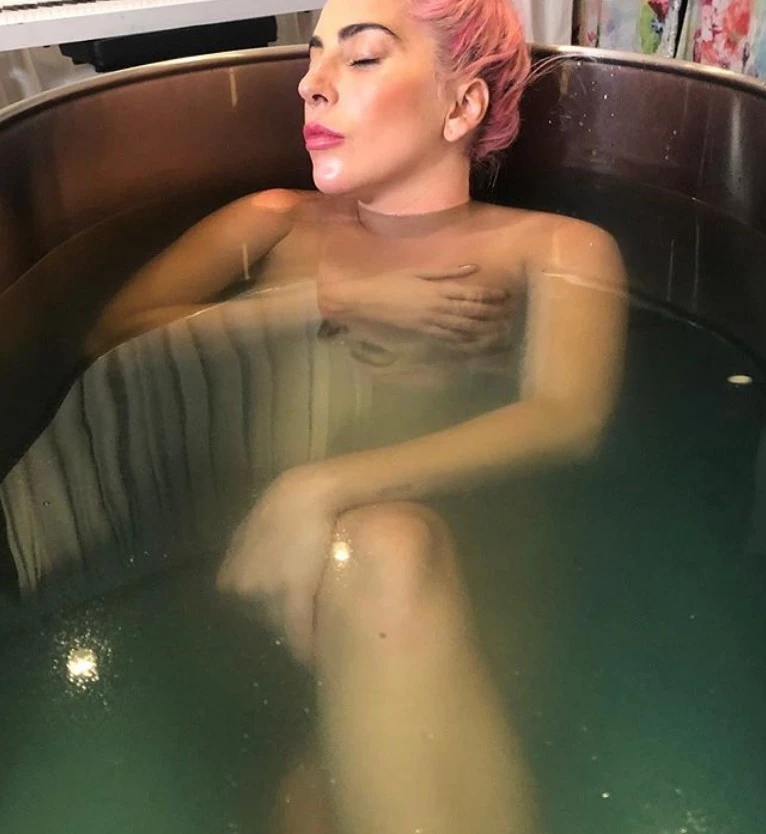 Lady Gaga | Γιατί γεμίζει την μπανιέρα με παγάκια και κάνει καυτά μπάνια; - εικόνα 2
