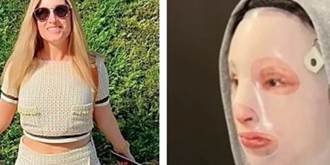 Επίθεση με βιτριόλι | "Επίπονο, αλλά θα πάω στο δικαστήριο", λέει η Ιωάννα