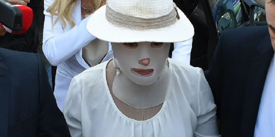 Η άγνωστη ιστορία της Ιωάννας Παλιοσπύρου | Ο αγώνας της ζωής της μέχρι την επίθεση με βιτριόλι