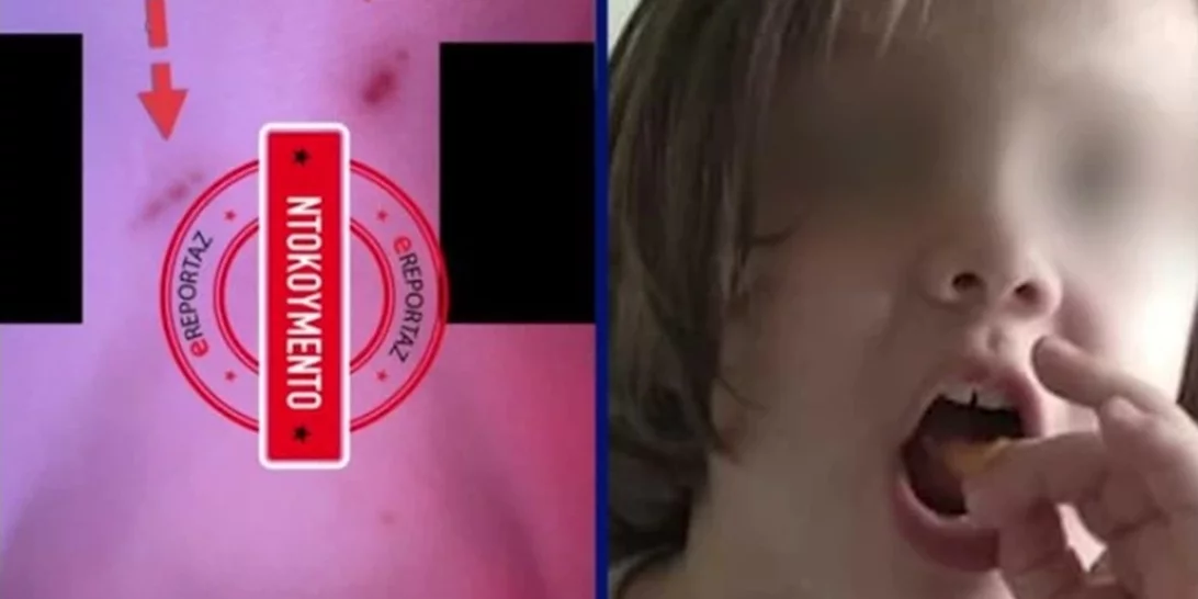 Πάτρα | Τα σημάδια στο πρόσωπο της Μαλένας δείχνουν δολοφονία - Προθανάτιες οι νυχιές στα μάγουλα [Βίντεο]