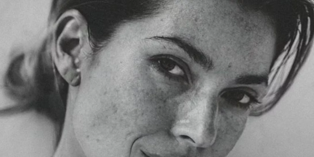 Oι ουλές στο σώμα της Βάσιας Κωσταρά δίνουν ένα μήνυμα ελπίδας