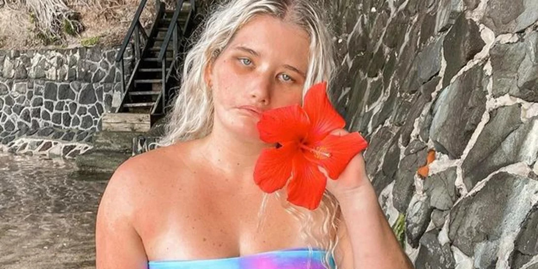 Tayla Clement | Η ιστορία του μοντέλου που δεν μπορεί να χαμογελάσει