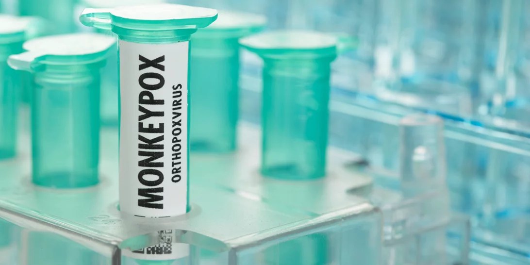 Δεύτερο κρούσμα ευλογιάς των πιθήκων | Κάθε Πέμπτη πλέον επίσημη ενημέρωση από τον ΕΟΔΥ