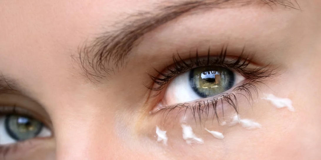 Ταλαιπωρείσαι από μαύρους κύκλους στα μάτια; Ο εύκολος τρόπος για να απαλλαχθείς από αυτούς μια και καλή