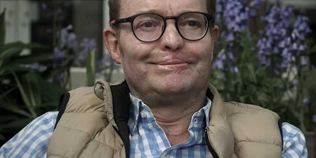 Βρετανία | Ο "βιονικός Υπουργός" επέστρεψε στα καθήκοντα του, μετά την περιπέτεια υγείας που του κόστισε τα χέρια και τα πόδια του