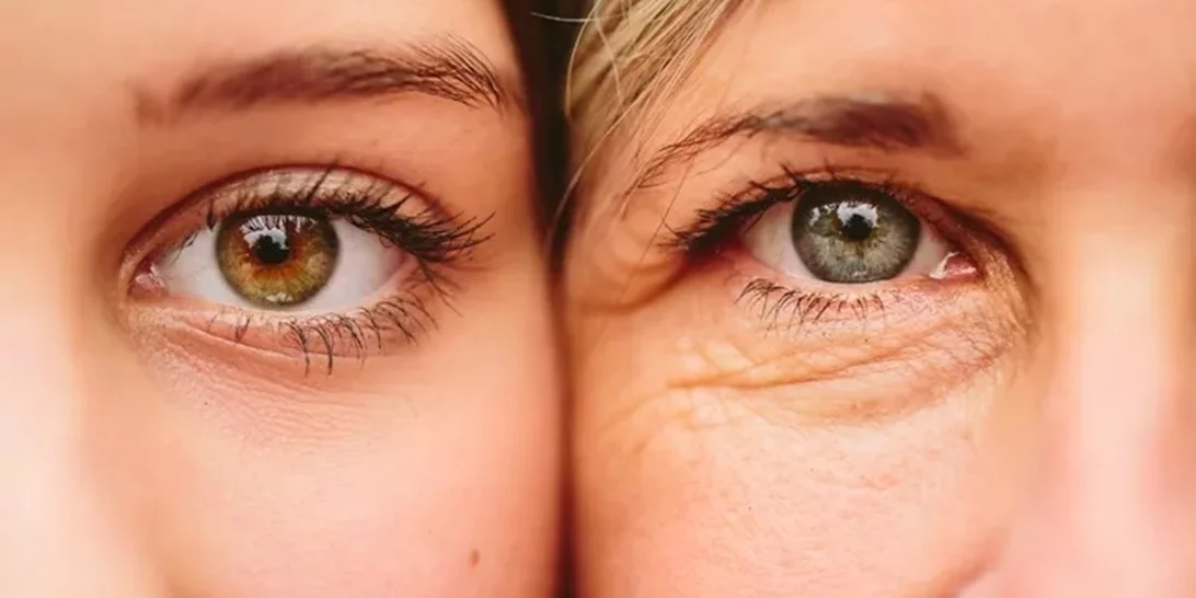8 αλάνθαστα βήματα για να μειώσεις τις ρυτίδες γύρω από τα μάτια