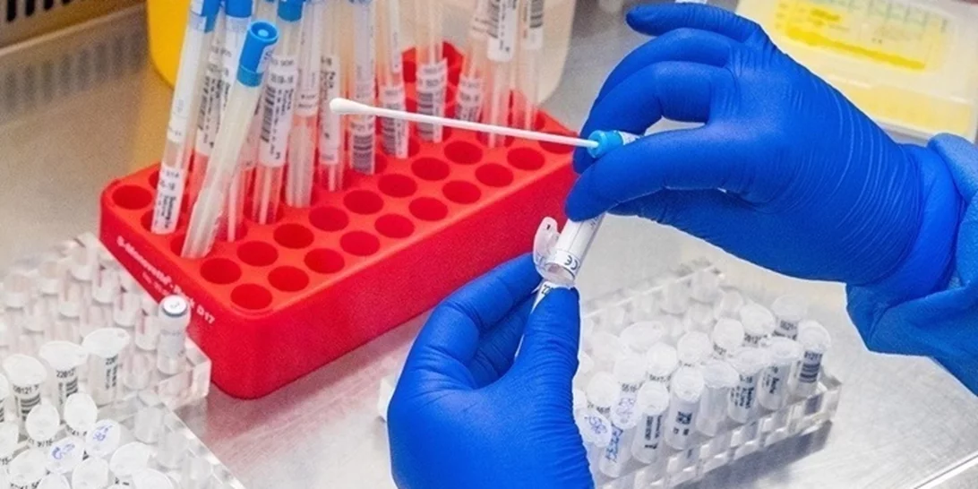 ΕΟΔΥ για κρούσματα στρεπτόκοκκου | Δεν πρέπει να κλείνουν τα σχολεία