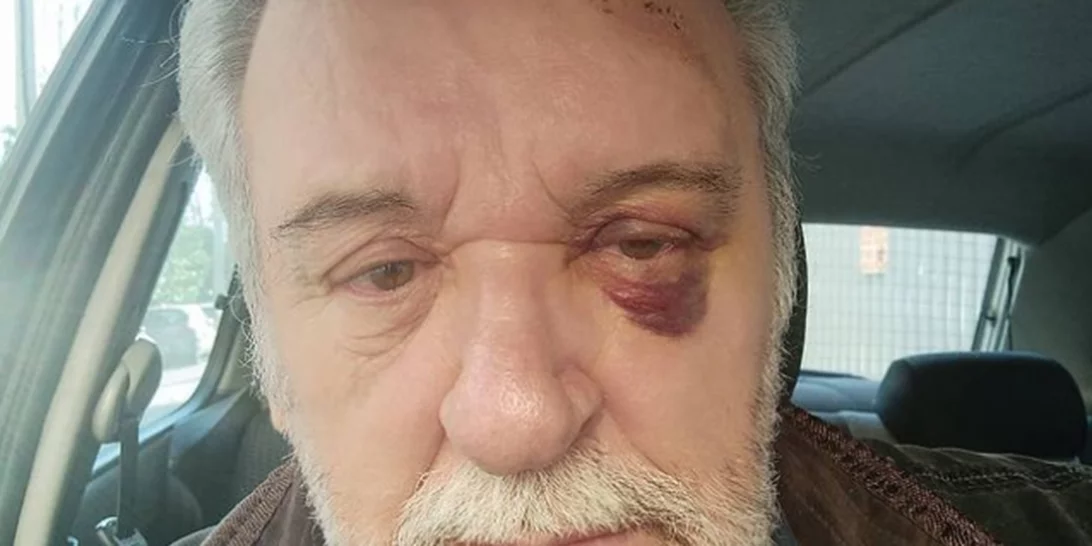 Τάσος Χαλκιάς | Ατύχημα για τον ηθοποιό (εικόνα)