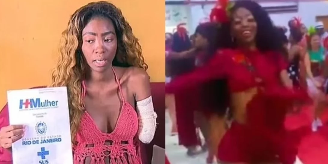 Εφιάλτης για Βραζιλιάνα χορεύτρια | Μπήκε στο νοσοκομείο για αφαίρεση ινομυωμάτων και της ακρωτηρίασαν το χέρι