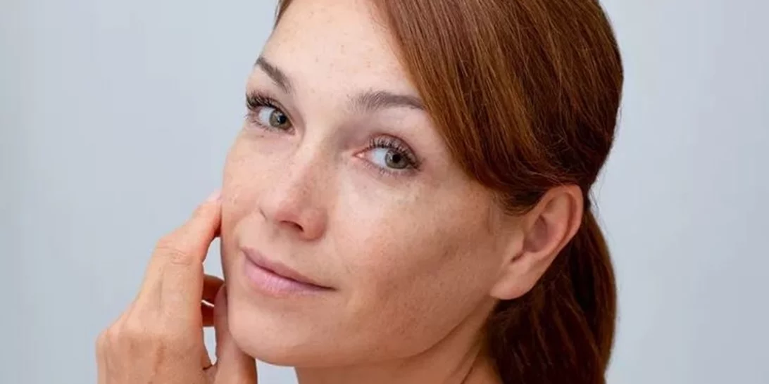 5 κρέμες που διορθώνουν τις καφέ κηλίδες και τα σημάδια