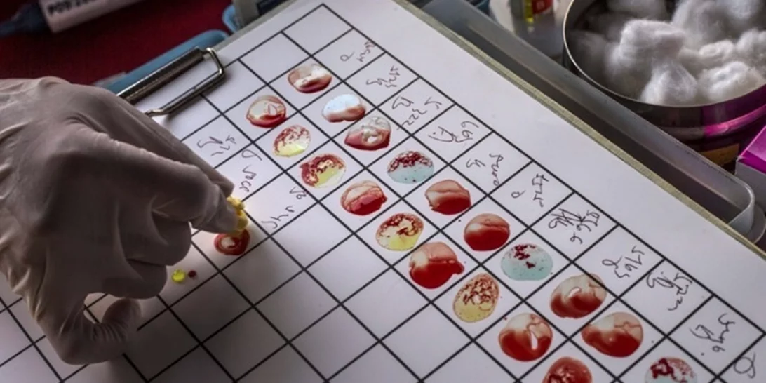 Απλή εξέταση αίματος μπορεί να προβλέψει τη νόσο του Crohn χρόνια πριν από την εμφάνιση των συμπτωμάτων