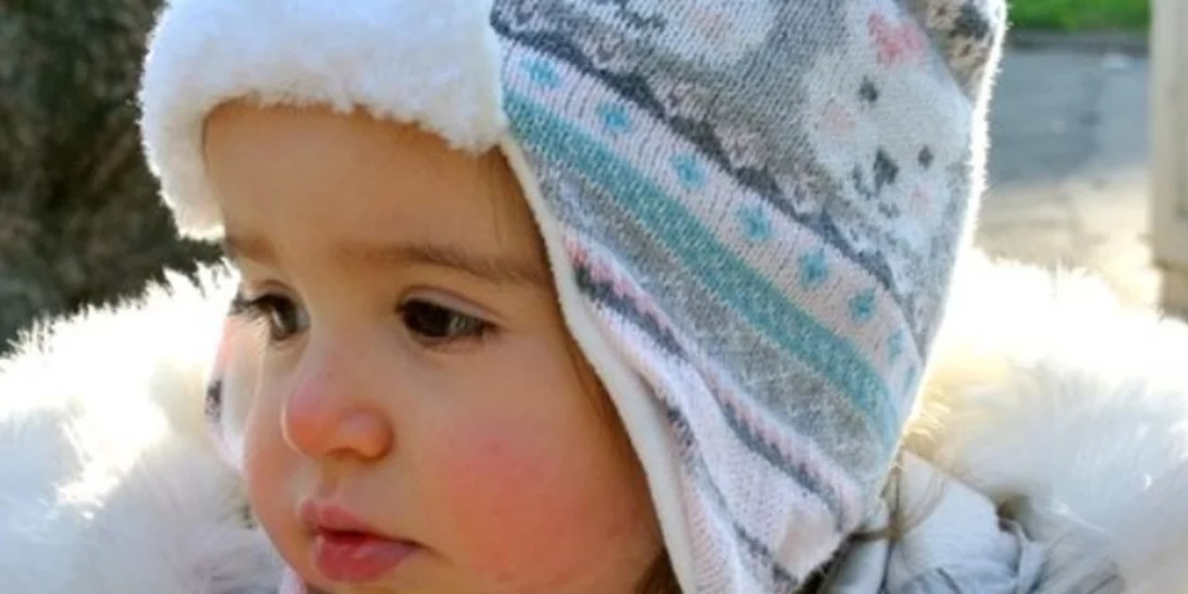 Γιατί το μωρό έχει κόκκινα μάγουλα; Οι πιθανές αιτίες και πότε να ανησυχήσεις