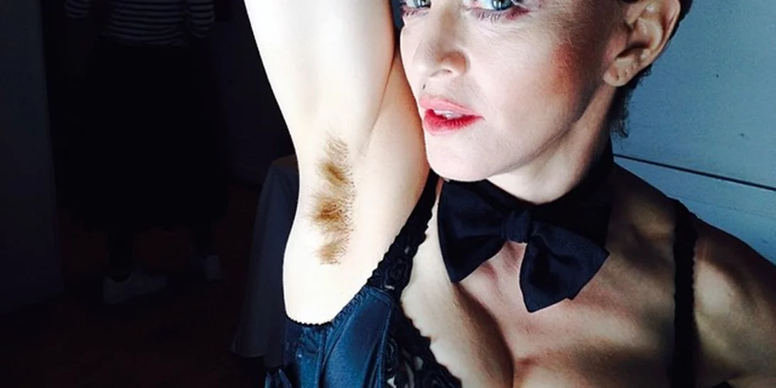 Αξύριστες και με ραγάδες | 10 αληθινές γυναίκες celebrities που δεν φοβούνται να δείξουν τις ατέλειές τους