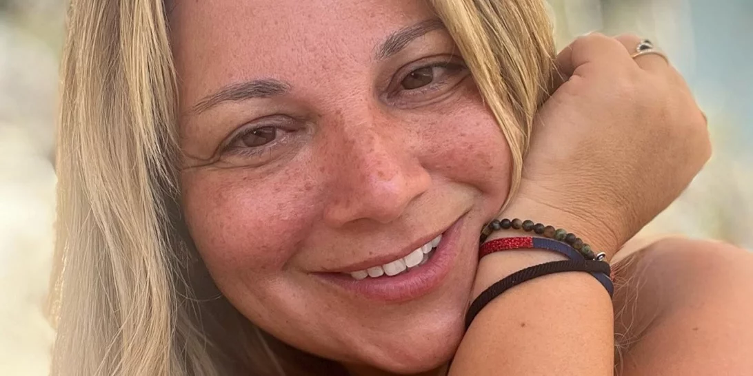 Χωρίς Φίλτρα | 8 Ελληνίδες celebrities που δείχνουν περήφανα τα "ψεγάδια" της επιδερμίδας τους