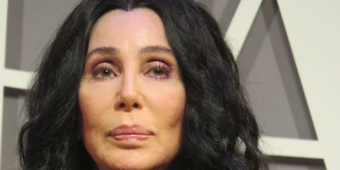Η Cher κάνει κλήση - έκπληξη σε θαυμάστριά της που πάσχει από Αλτσχάιμερ
