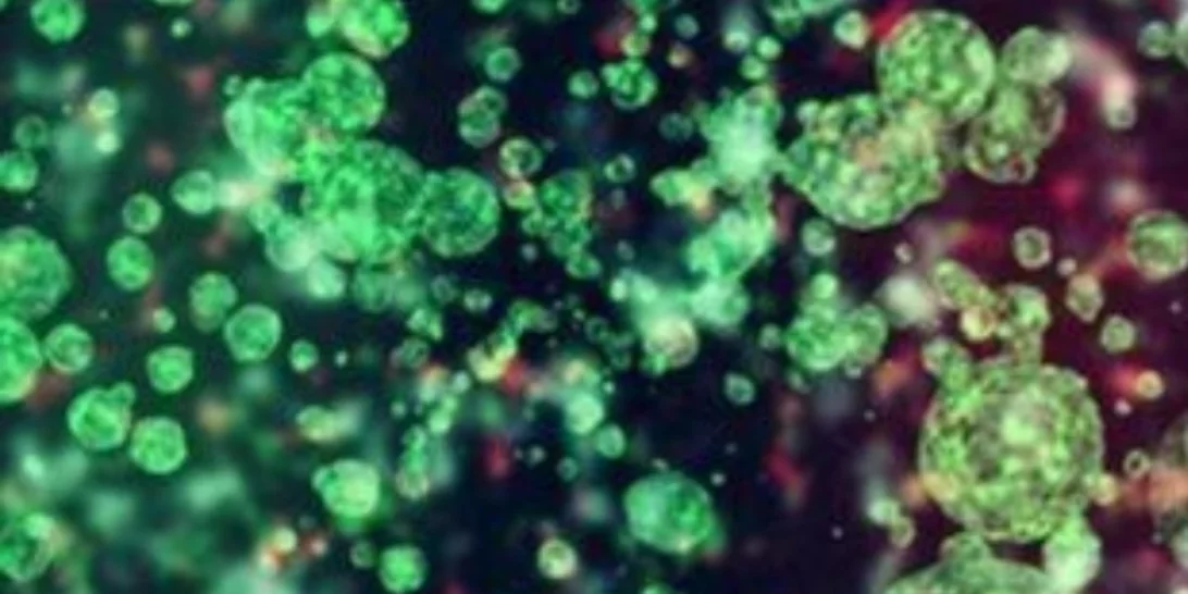 Τα σεξουαλικώς μεταδιδόμενα νοσήματα αυξάνονται ραγδαία στην Ευρώπη