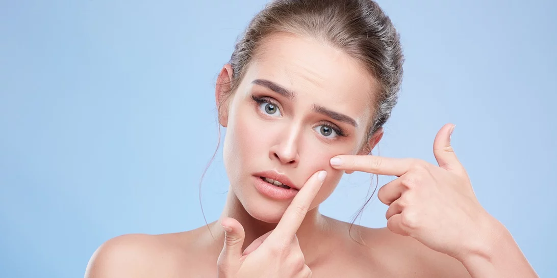 Έβγαλες ξαφνικά σπυράκια; Να τι μπορεί να φταίει