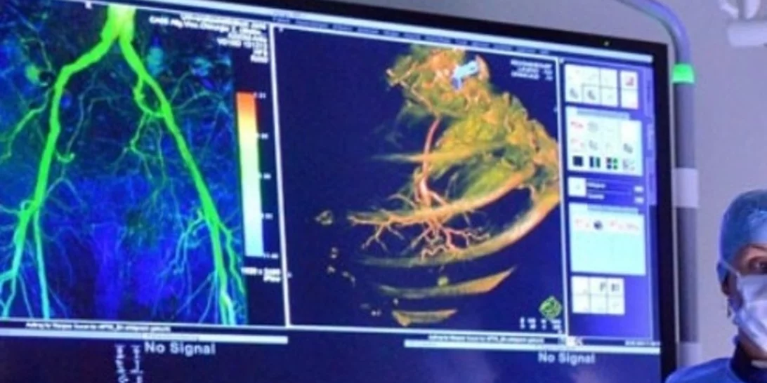 Μέθοδος εντοπισμού της γήρανσης των ανθρώπινων οργάνων προβλέπει τον κίνδυνο ασθενειών