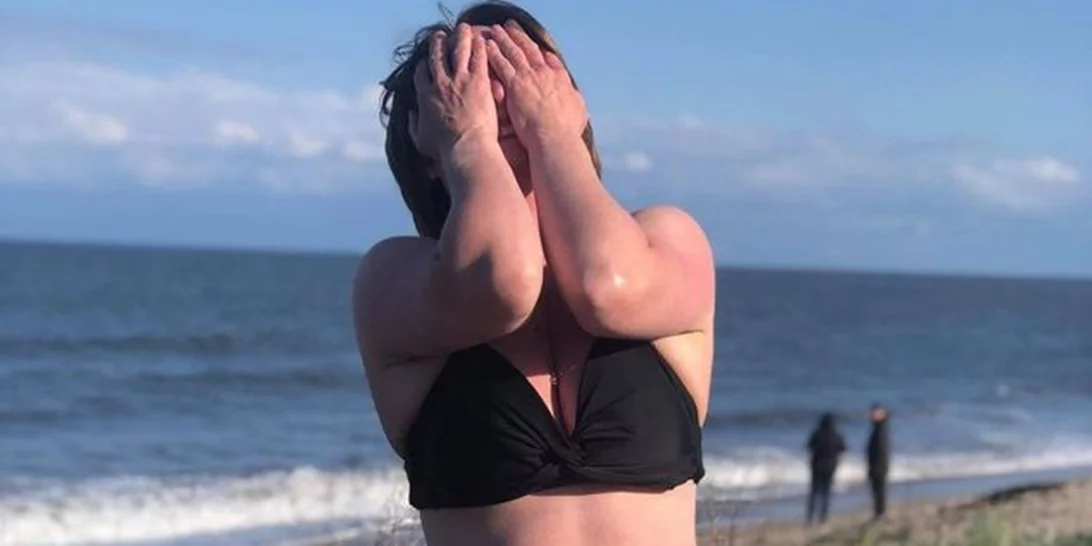 Γυναίκα με κολοστομία φοράει μπικίνι. Ετοιμάζεται να διασχίσει κολυμπώντας το Στενό της Μάγχης