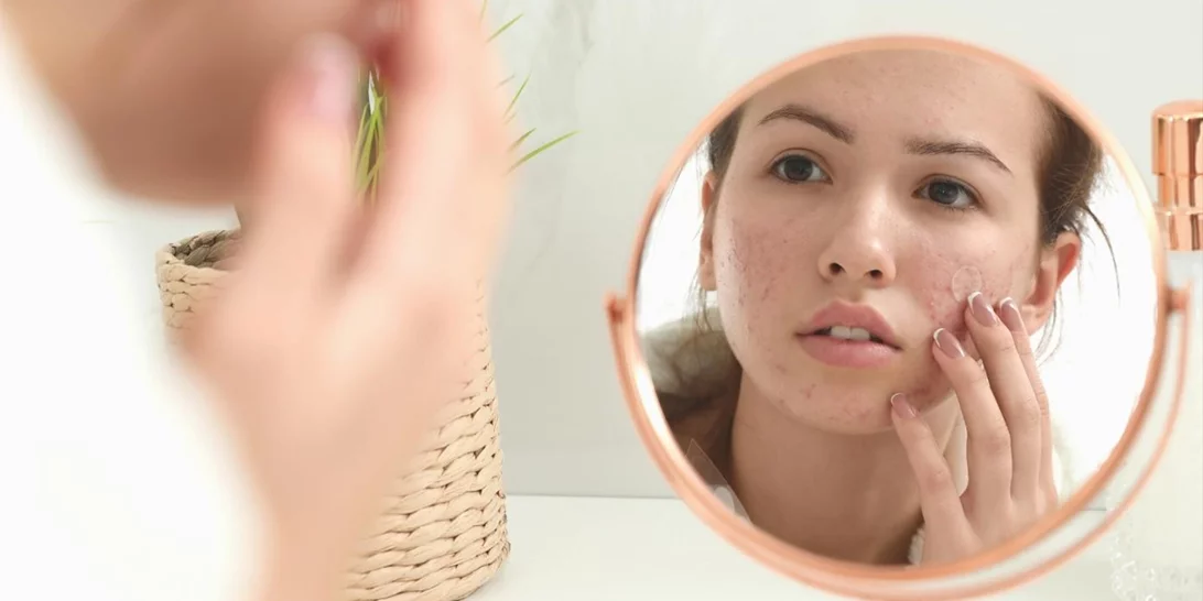 Glow up your skin | Τα καλύτερα προϊόντα περιποίησης για ευαίσθητες επιδερμίδες