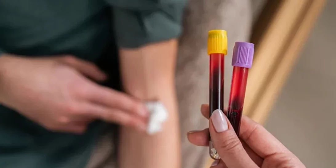 Καρκίνος στο πάγκρεας | Η απλή εξέταση που ανακάλυψαν οι επιστήμονες