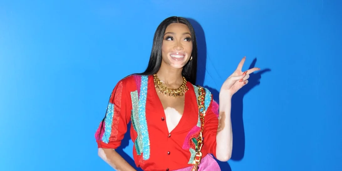 Το καλοκαίρι φοράμε χρώματα αλλά καλό είναι να αποφύγεις αυτούς τους 3 συνδυασμούς