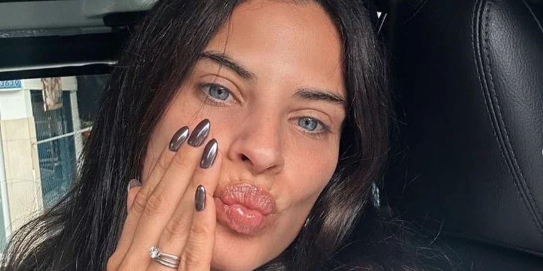 Χριστίνα Μπόμπα | Δείχνει τα σημάδια στο πρόσωπό της που είναι κληρονομικά