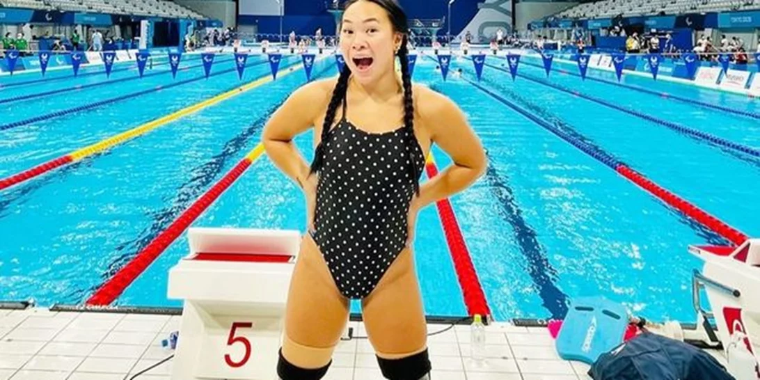 H ιστορία της γενναίας Ηaven Shepherd που ακρωτηριάστηκε όταν ήταν μόλις 14 μηνών