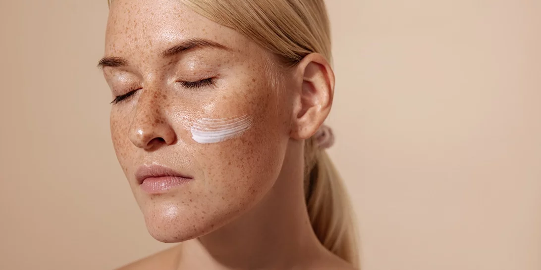 Οι 5 καλύτερες κρέμες για σημάδια ακμής που θα βρεις στο φαρμακείο της γειτονιάς σου