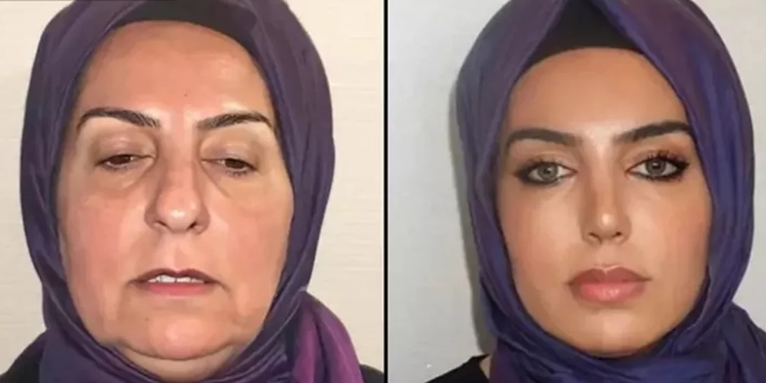 H ολική μεταμόρφωση της 68χρονης Ντιλέκ