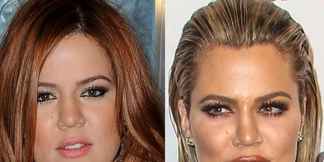 Πώς ήταν και πώς έγινε | Η Khloe Kardashian και η τεράστια μεταμόρφωσή της