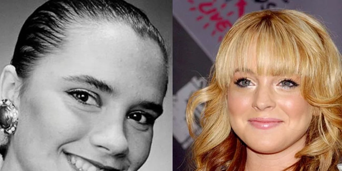 Πριν και μετά τις πλαστικές: Οι επώνυμοι που πλέον τρομάζουμε να αναγνωρίσουμε!