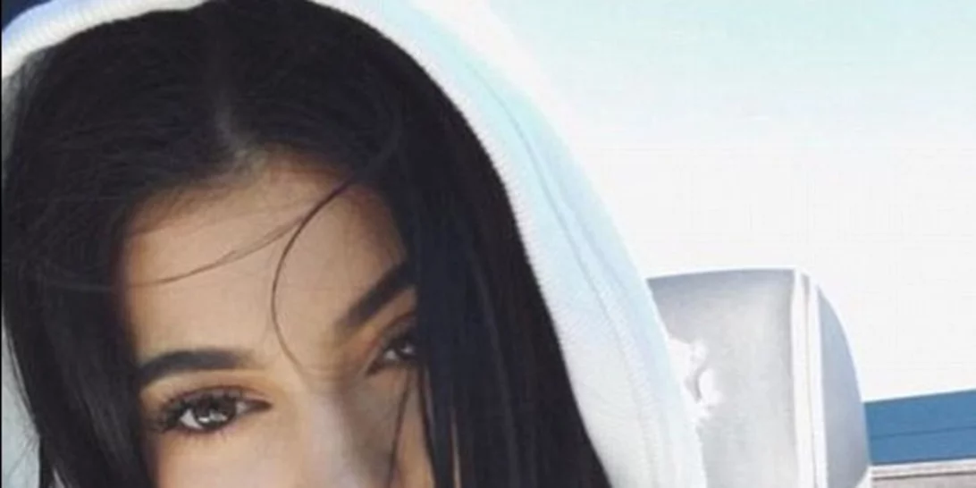 Η Kylie Jenner λέει... «αντίο» στα μεγάλα χείλη της;