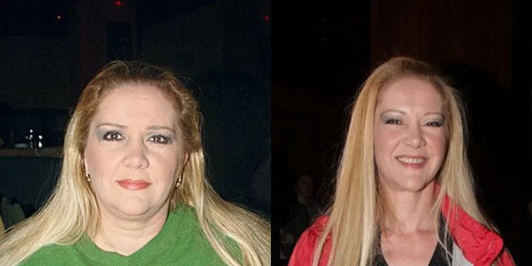 Αυτοί οι διάσημοι Έλληνες έχασαν κιλά και πλέον δεν τους αναγνωρίζουμε