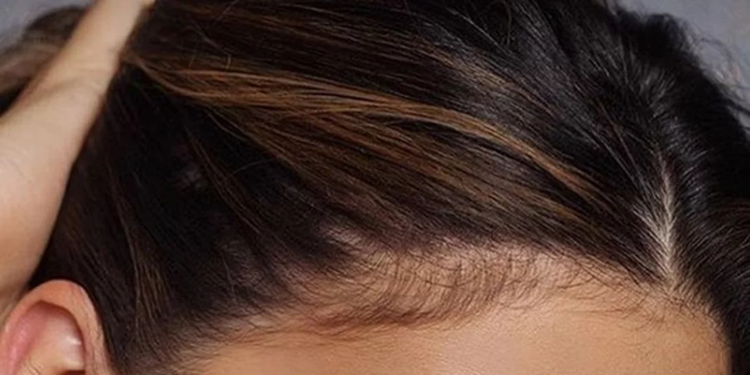 Πώς θα κάνεις contouring ανάλογα με το σχήμα του προσώπου σου