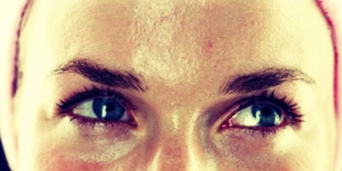 Λιπαρότητα στο πρόσωπο; Απαγορεύεται να κάνεις αυτή την κίνηση!