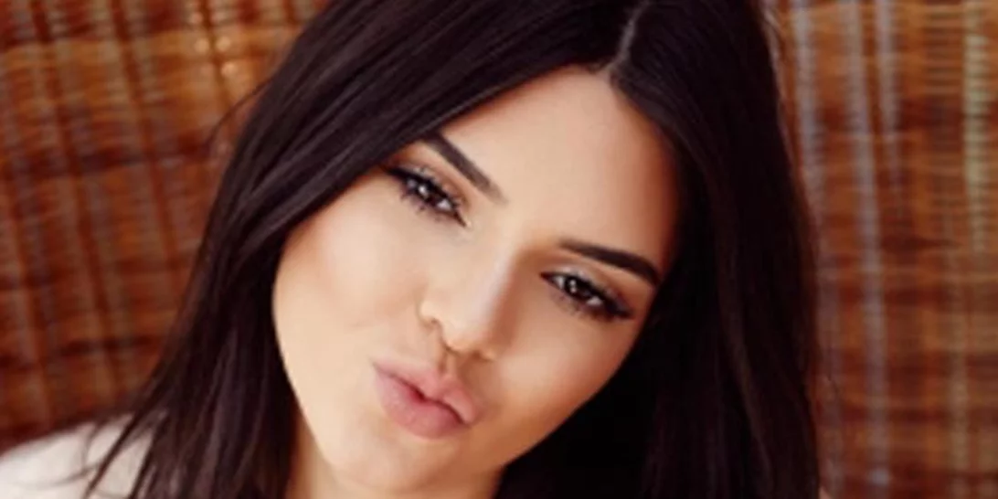 Η Kendall Jenner έκανε πλαστική στα χείλη της και εμείς τρομάξαμε λίγο!
