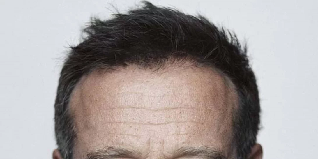 Η γυναίκα του Robin Williams υποστηρίζει πώς ο ηθοποιός αυτοκτόνησε λόγω άνοιας