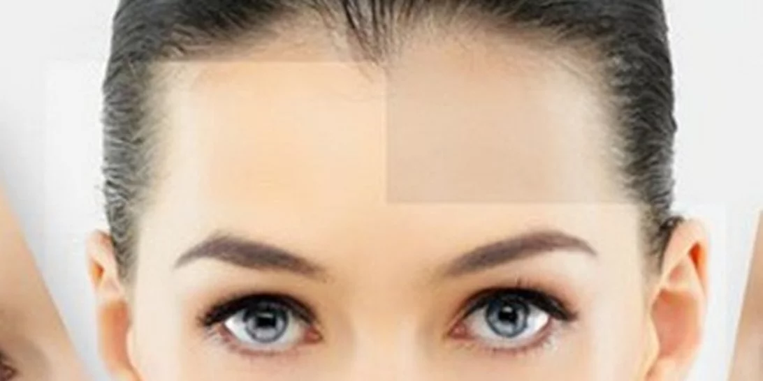 Έχεις λιπαρό-μεικτό δέρμα με τάση ακμής; Αυτή είναι η απόλυτη λύση για εσένα