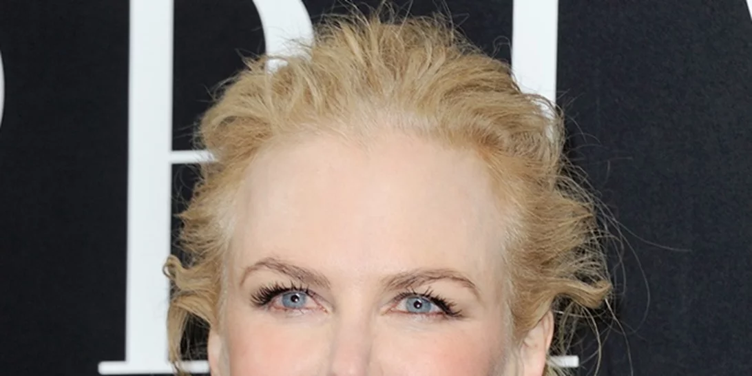 Nicole Kidman: Μήπως το παράκανε με το μπότοξ;