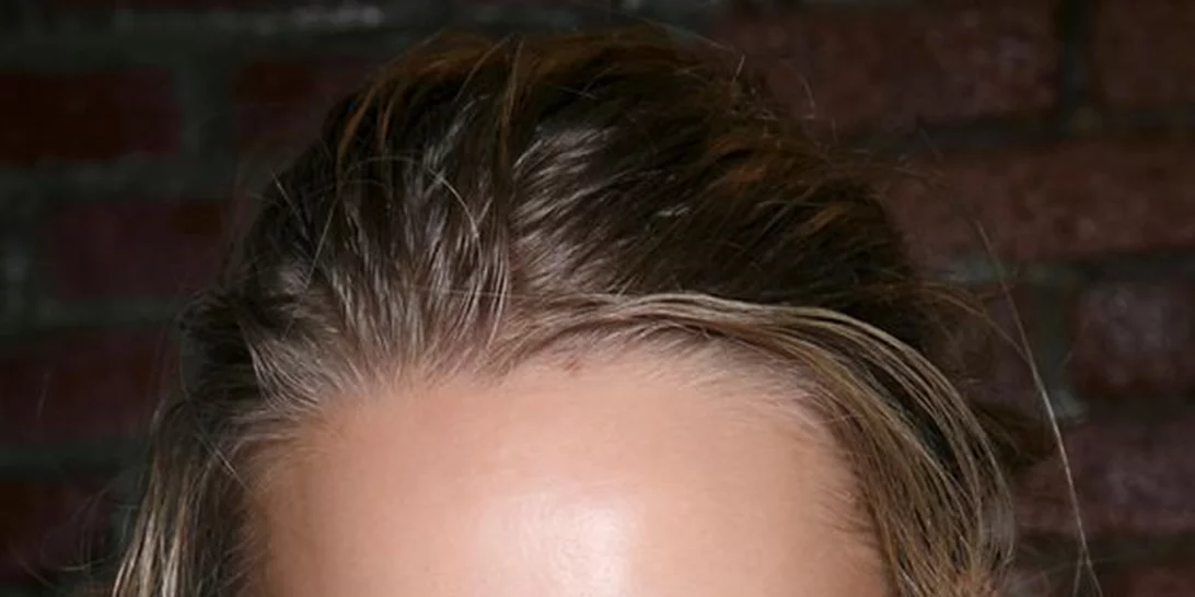 Εσύ, αλήθεια, είσαι σίγουρη ότι προστατεύεις σωστά την επιδερμίδα σου;