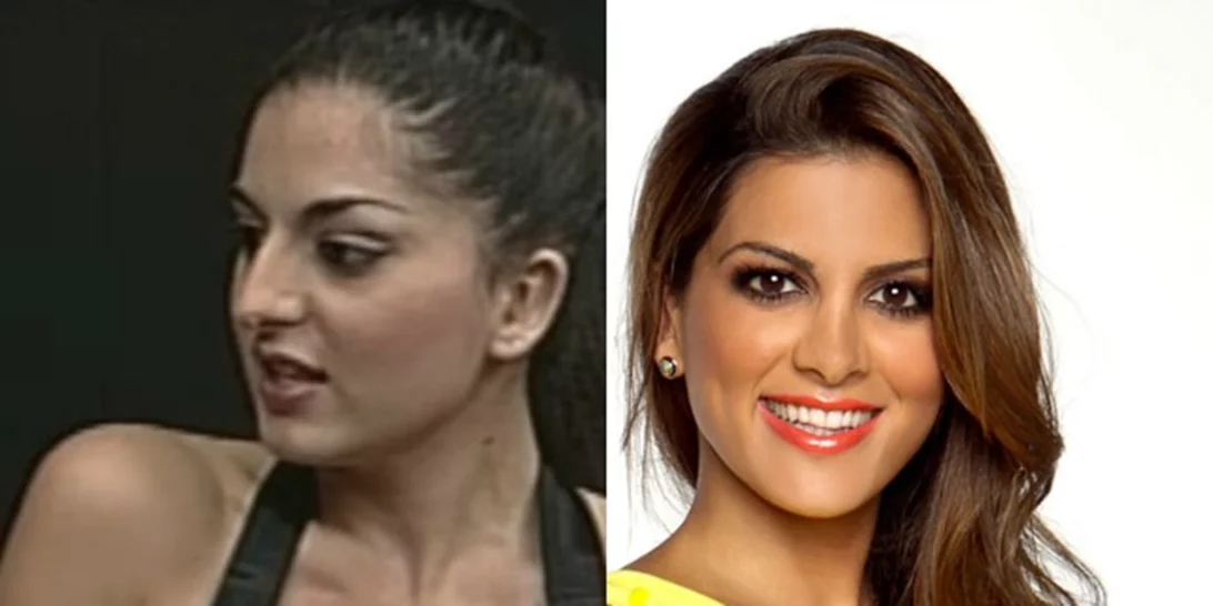 7+1 Ελληνίδες celebrities πριν και μετά την πλαστική μύτης
