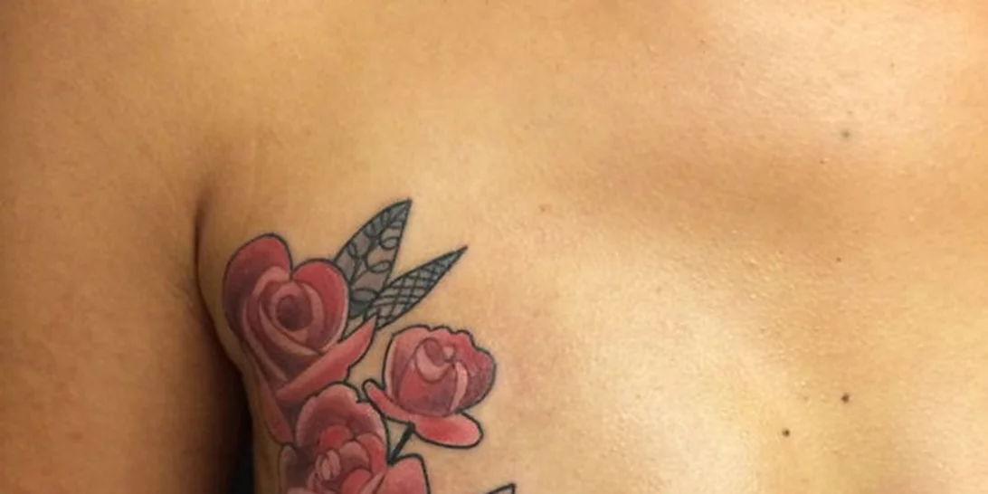 Όταν τα σημάδια του σώματος μετατρέπονται σε πανέμορφα τατουάζ