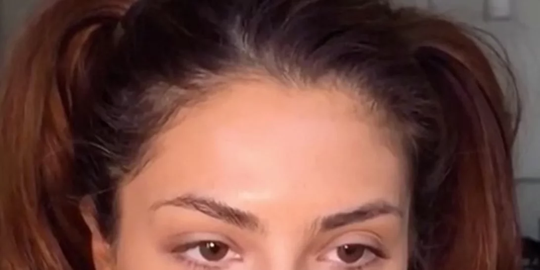 Οι μαύροι πόροι είναι πια παρελθόν με αυτή την μυστική συνταγή