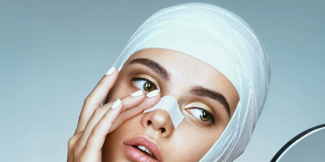 Ρινοπλαστική: Όλα όσα πρέπει να ξέρεις για να το τολμήσεις επιτέλους!