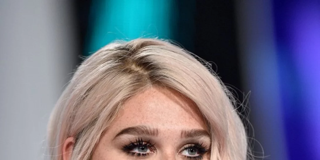 Η απλή selfie της Kesha ρίχνει το Twitter γι' αυτό τον λόγο...